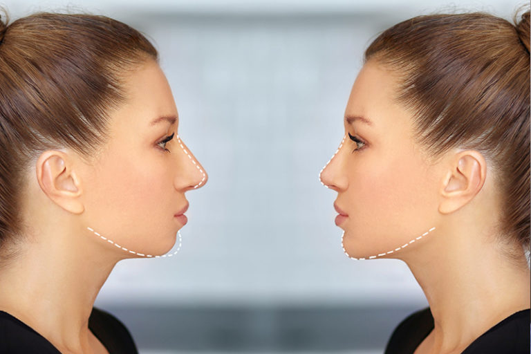 Facial Surgery | Baton Rouge, LA | Oral Surgeons