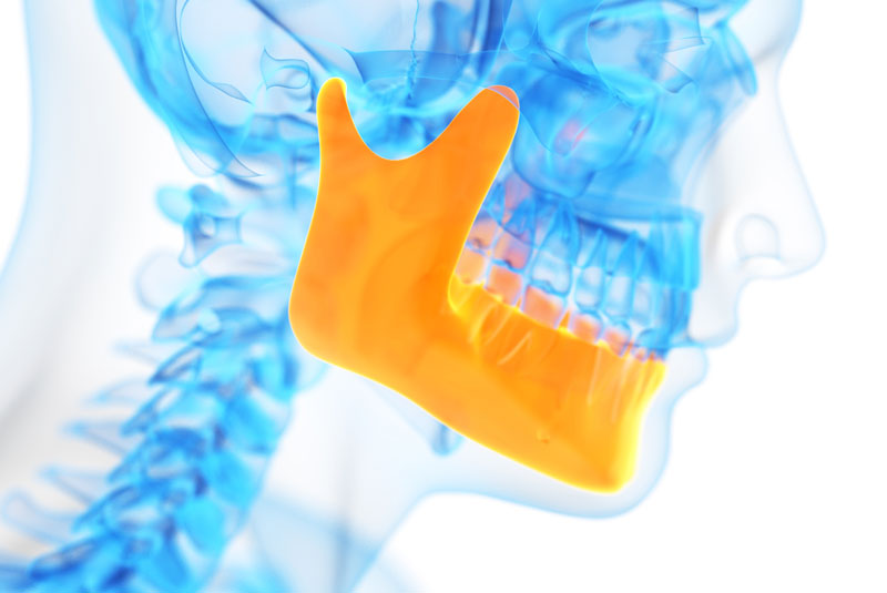a jaw bone x-ray showing signs of TMJ disorder