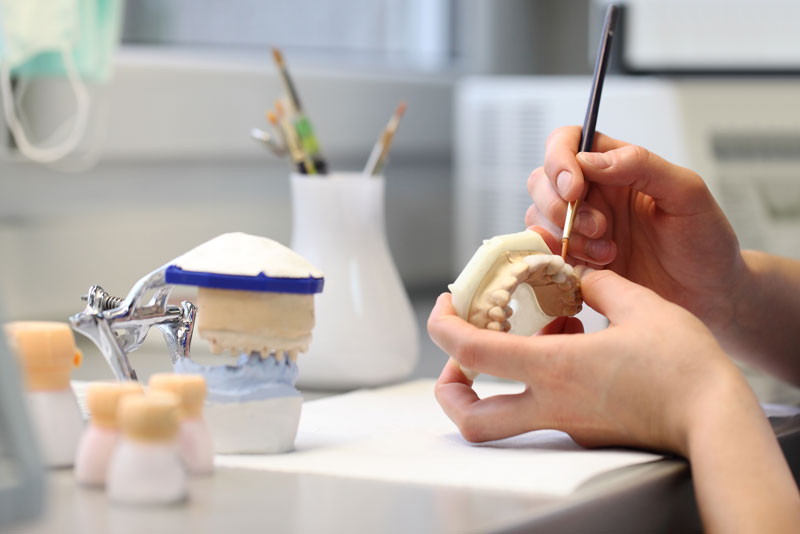 a picture of a dental professionals hands as he is painting a a customized full mouth dental implant prosthetic.