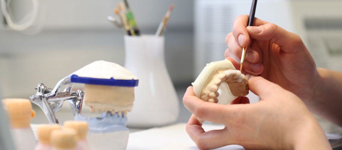 a picture of a dental professionals hands as he is painting a a customized full mouth dental implant prosthetic.